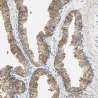 Anti-ATF6 Antibody