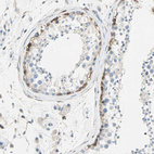 Anti-ATF6 Antibody