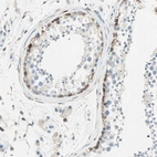 Immunohistochemical staining of human testis shows moderate cytoplasmic positivity in a subset of cells in seminiferous ducts.