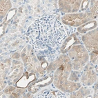 Immunohistochemical staining of human kidney shows weak to moderate cytoplasmic positivity in cells in tubules.