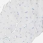 Immunohistochemical staining of human skeletal muscle shows no positivity in myocytes as expected.