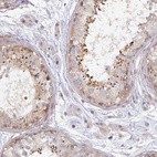 Immunohistochemical staining of human testis shows moderate cytoplasmic positivity in cells in seminiferous ducts.