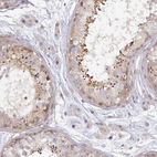 Immunohistochemical staining of human testis shows moderate cytoplasmic positivity in cells in seminiferous ducts.