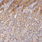 Immunohistochemical staining of human stomach shows moderate cytoplasmic positivity in parietal cells.