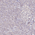 Immunohistochemical staining of human pancreas shows no positivity in exocrine glandular cells as expected.