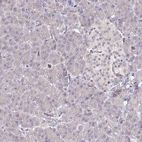 Immunohistochemical staining of human pancreas shows no positivity in exocrine glandular cells as expected.