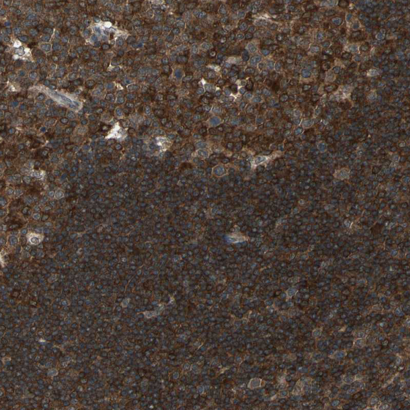 Anti-NFKBIE Antibody