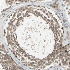 Immunohistochemical staining of human testis shows moderate cytoplasmic positivity in cells in seminiferous ducts.