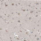 Immunohistochemical staining of human cerebral cortex shows weak to moderate cytoplasmic positivity in neurons.