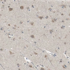 Immunohistochemical staining of human cerebral cortex shows weak to moderate cytoplasmic positivity in neurons.
