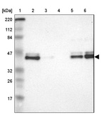Lane 1: Marker [kDa] 220, 112, 84, 47, 32, 26, 17_br/_Lane 2: Human cell line RT-4_br/_Lane 3: Human cell line U-251MG sp_br/_Lane 4: Human plasma (IgG/HSA depleted)_br/_Lane 5: Human liver tissue_br/_Lane 6: Human tonsil tissue