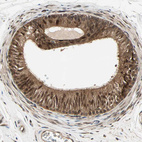 Anti-CSNK2B Antibody