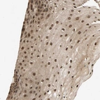Immunohistochemical staining of human skin shows strong nuclear and cytoplasmic positivity in squamous epithelial cells.