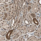 Immunohistochemical staining of human kidney shows moderate nuclear and cytoplasmic positivity in cells in tubules.