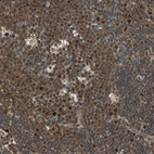 Immunohistochemical staining of human lymph node shows strong nuclear and cytoplasmic positivity in germinal center cells.