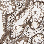 Immunohistochemical staining of human rectum shows strong nuclear and cytoplasmic positivity in glandular cells.