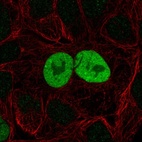 Anti-CDKN1A Antibody