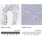 Anti-AKAP4 Antibody