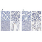 Immunohistochemical staining of human endometrium, gastrointestinal, liver and testis using Anti-AKAP4 antibody HPA005949 (A) shows similar protein distribution across tissues to independent antibody HPA020046 (B).