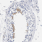 Immunohistochemical staining of human testis shows strong cytoplasmic positivity in spermatids.