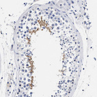 Anti-AKAP4 Antibody