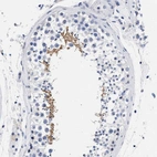 Immunohistochemical staining of human testis shows strong cytoplasmic positivity in spermatids.