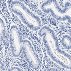 Immunohistochemical staining of human endometrium shows no cytoplasmic positivity in glandular cells as expected.