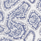 Immunohistochemical staining of human small intestine shows no cytoplasmic positivity in glandular cells as expected.