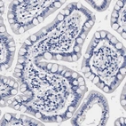 Immunohistochemical staining of human small intestine shows no cytoplasmic positivity in glandular cells as expected.