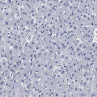 Immunohistochemical staining of human liver shows no cytoplasmic positivity in hepatocytes as expected.