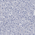 Anti-AKAP4 Antibody