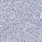 Immunohistochemical staining of human liver shows no cytoplasmic positivity in hepatocytes as expected.