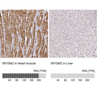 Anti-MYOM2 Antibody