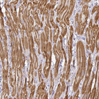 Immunohistochemical staining of human heart muscle shows strong cytoplasmic positivity in cardiomyocytes.