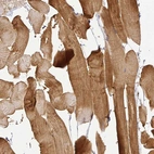 Immunohistochemical staining of human skeletal muscle shows strong cytoplasmic positivity in myocytes.