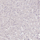 Anti-MYOM2 Antibody