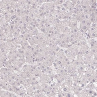 Immunohistochemical staining of human liver shows no positivity in hepatocytes as expected.