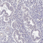 Anti-MYOM2 Antibody