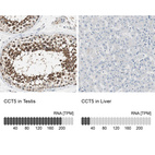 Anti-CCT5 Antibody