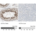 Anti-CCT5 Antibody