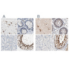 Immunohistochemical staining of human cerebral cortex, colon, liver and testis using Anti-CCT5 antibody HPA005958 (A) shows similar protein distribution across tissues to independent antibody HPA002238 (B).