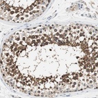 Immunohistochemical staining of human testis shows high expression.