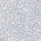 Immunohistochemical staining of human liver shows low expression as expected.