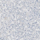 Anti-CCT5 Antibody