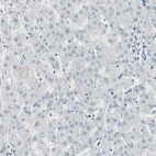 Immunohistochemical staining of human liver shows low expression as expected.
