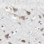 Anti-CCT5 Antibody