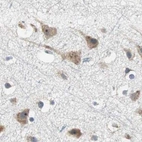 Immunohistochemical staining of human cerebral cortex using Anti-CCT5 antibody HPA005958.
