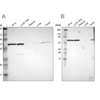 Western blot analysis using Anti-CCT5 antibody HPA005958 (A) shows similar pattern to independent antibody HPA002238 (B).