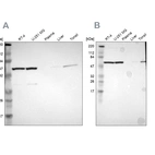 Western blot analysis using Anti-CCT5 antibody HPA005958 (A) shows similar pattern to independent antibody HPA002238 (B).