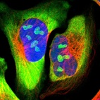 Immunofluorescent staining of human cell line U-2 OS shows localization to nucleoli & cytosol.